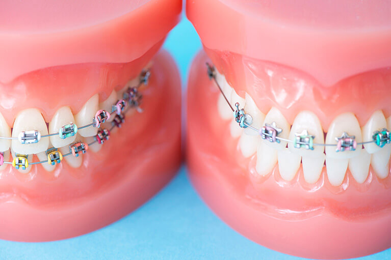 歯並びのことでお悩みではありませんか？